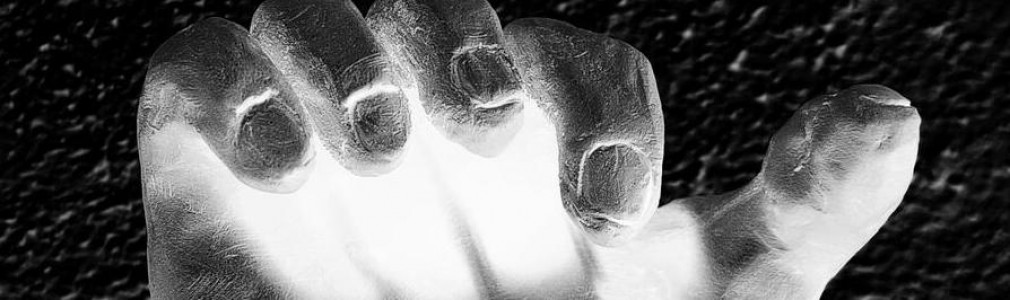 Auga, lodo e capital